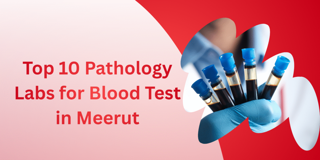 Top 10 Pathology Labs for Blood Test in Meerut