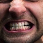 Teeth Grinding Bruxism