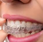 Invisalign Dubai