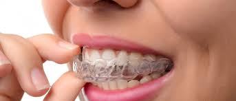 Invisalign Dubai