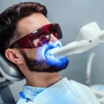Teeth Whitening in Dubai
