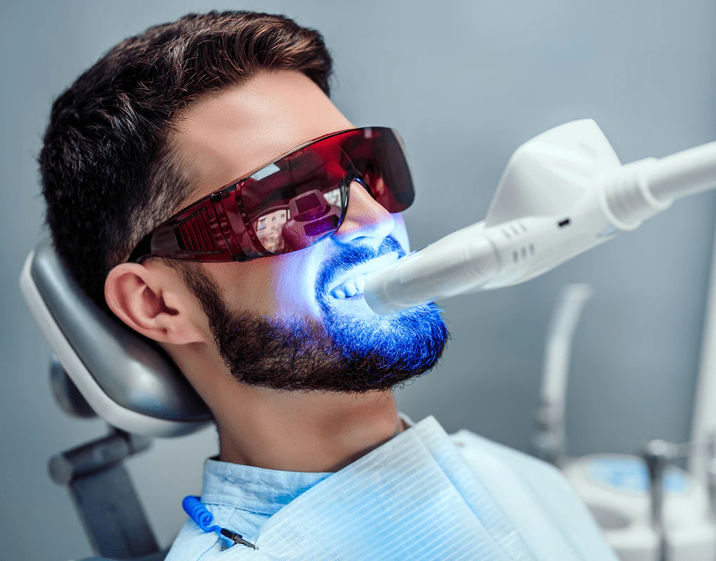 Teeth Whitening in Dubai